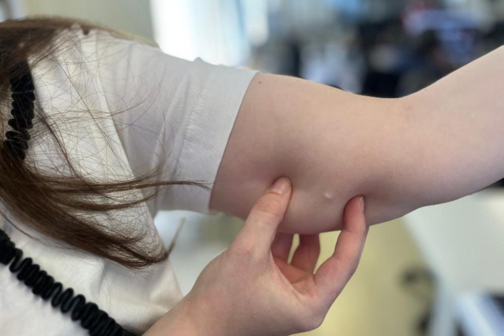 Método contraceptivo com 99% de eficácia é oferecido pelo SUS em Garibaldi