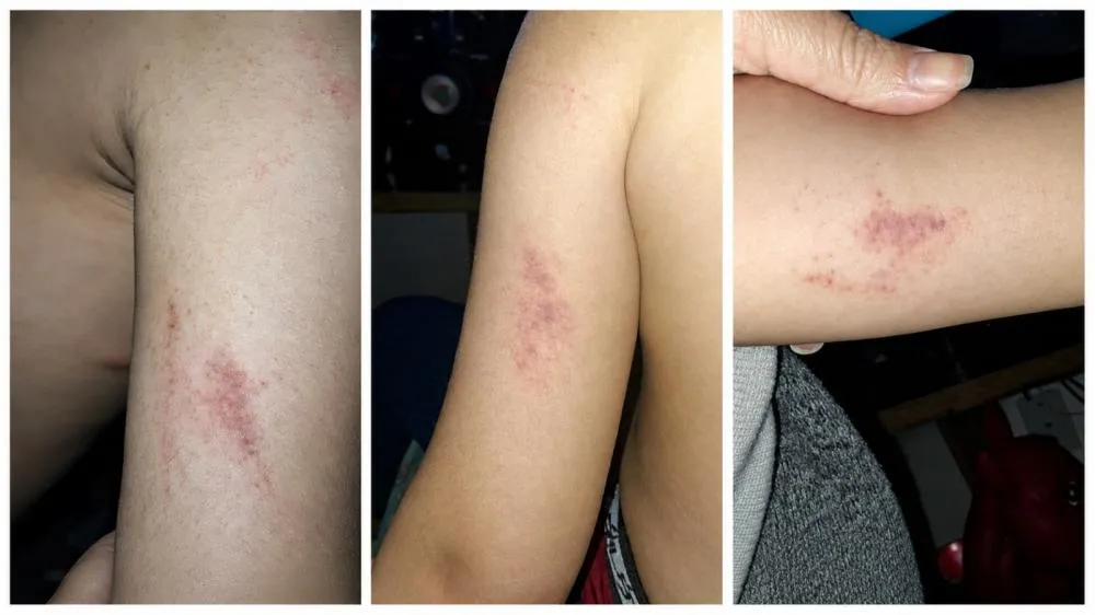 Criança com autismo sofre suposta agressão em escola de Bento Gonçalves